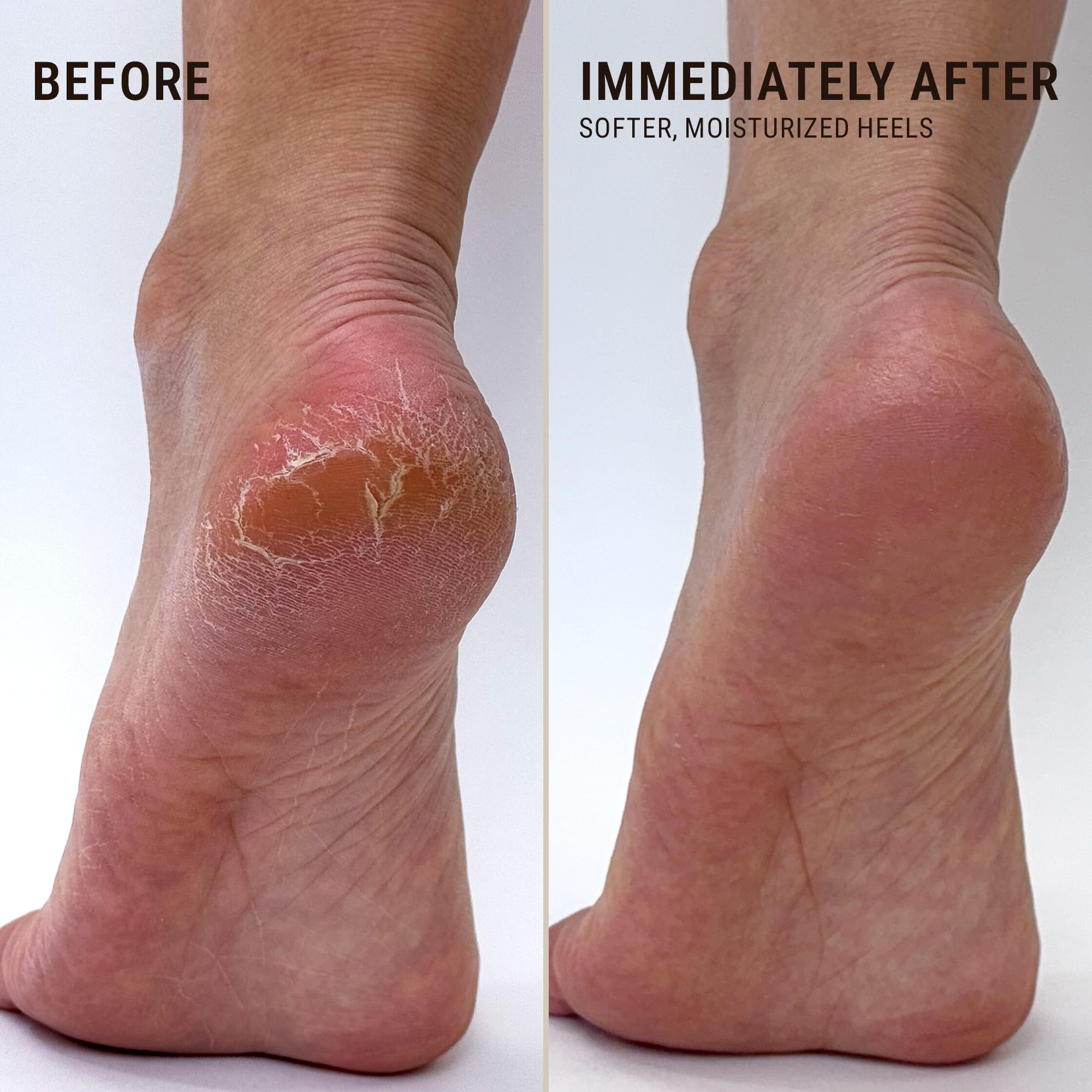 Moisturizer Heel Repair Solemate Balm